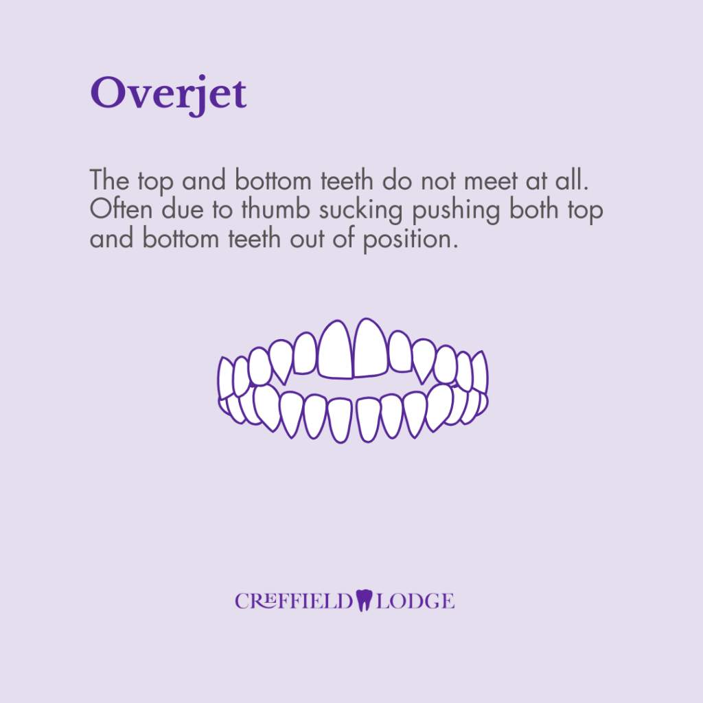 Creffield Lodge Dental Practice Social Media Post