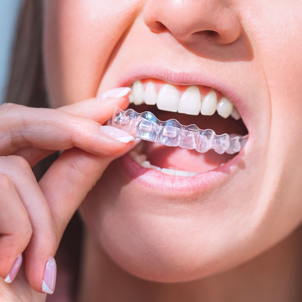 Dr Jack Acorn Invisalign  Dentist